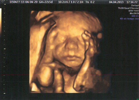 Enceinte maman ventre photo échographie échographie cadre photo en